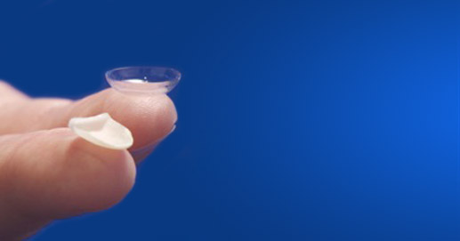 Odontoiatria Estetica - Faccetta Lumineers