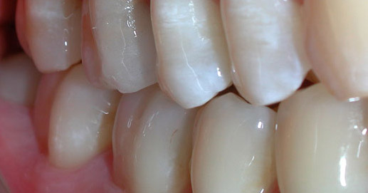 Odontoiatria Biologica - Visita Bio Odontoiatrica