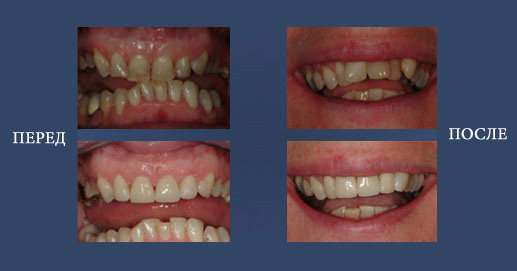 Грани Lumineers