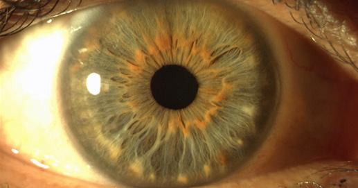 Osteopatia e Terapie Integrate - Fotografia Iride