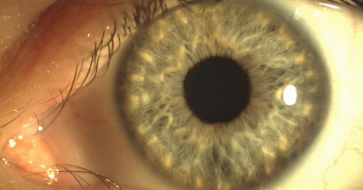 Osteopatia e Terapie Integrate - Fotografia Iride