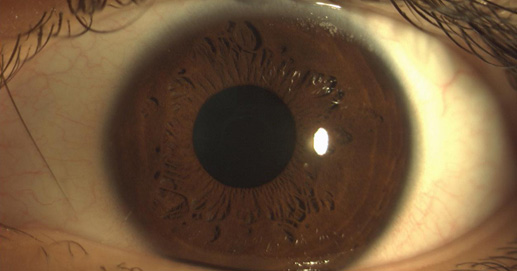 Osteopatia e Terapie Integrate - Fotografia Iride