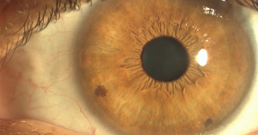 Osteopatia e Terapie Integrate - Fotografia Iride